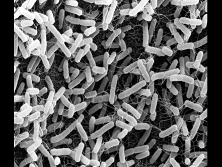 Image of bacteria under a microscope