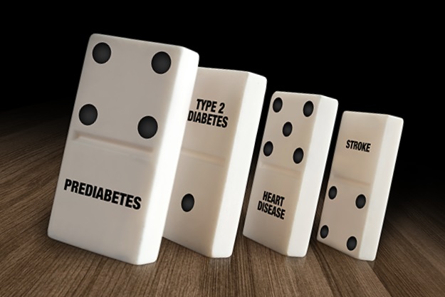Stop the domino effect of prediabetes.  Left untreated, prediabetes can lead to type 2 diabetes, heart disease, and stroke.